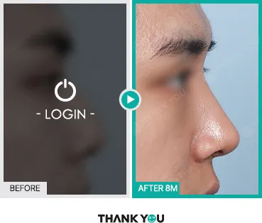 Before/After