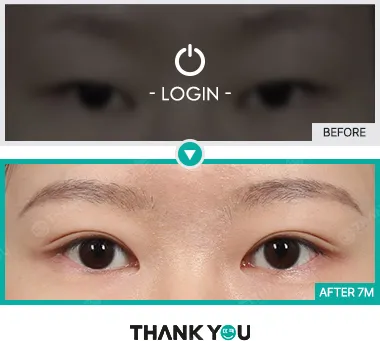 Before/After