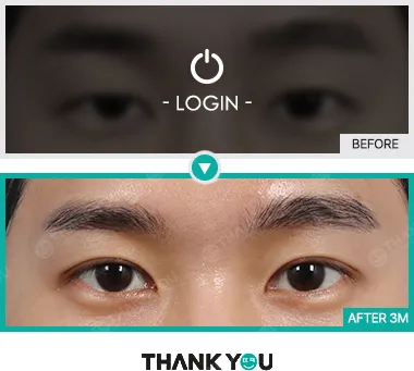 Before/After