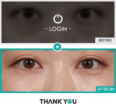 Before/After