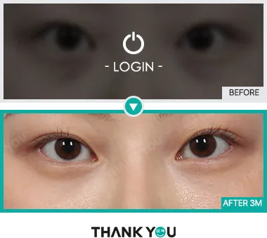 Before/After