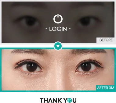 Before/After