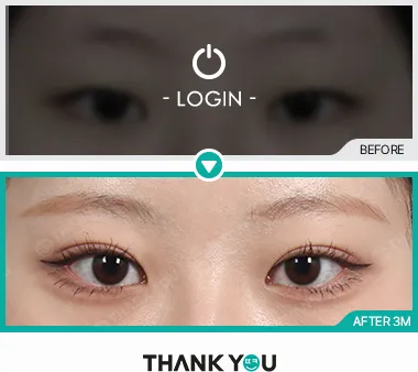 Before & After