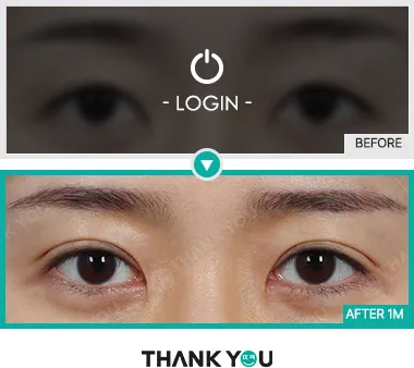 Before/After