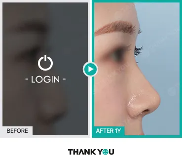 Before/After