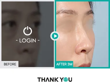Before/After