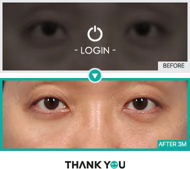 Before/After