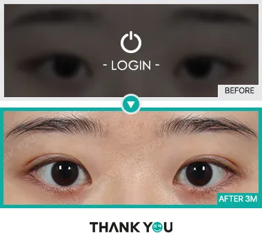 Before/After