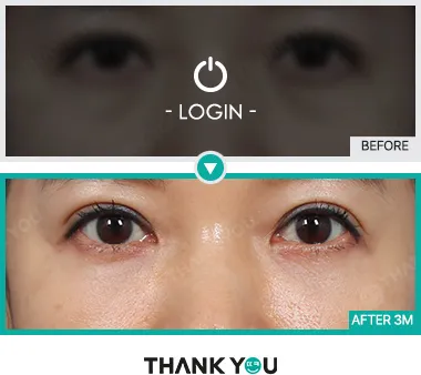 Before/After