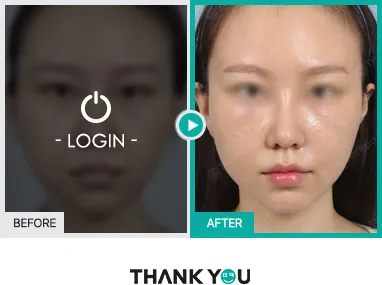 Before/After