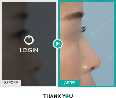 Before/After