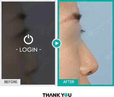 Before/After