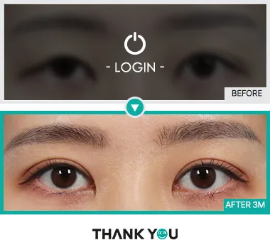 Before/After