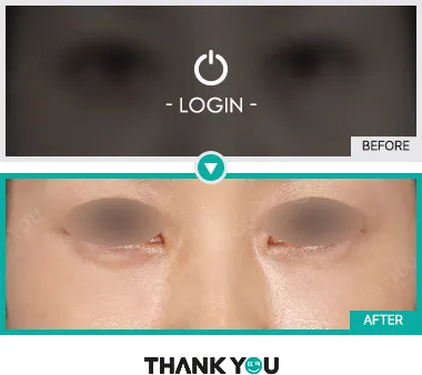Before/After