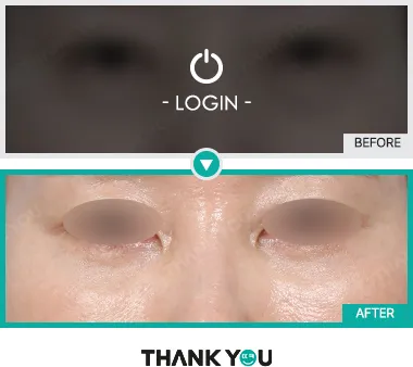 Before/After