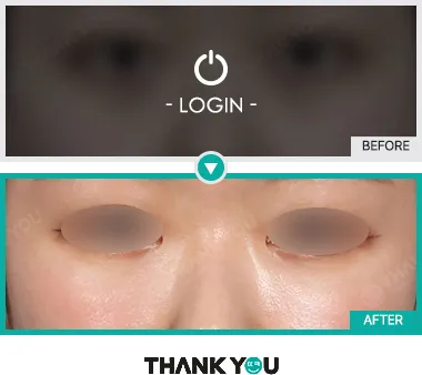 Before/After