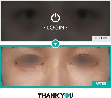 Before/After