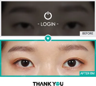 Before/After