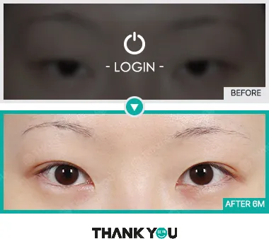 Before & After