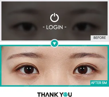 Before/After
