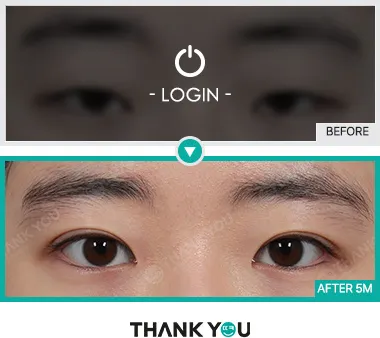 Before/After