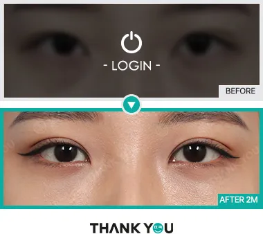 Before/After