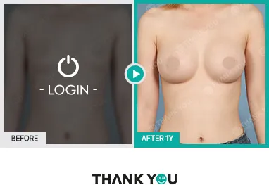 Before/After