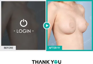 Before/After