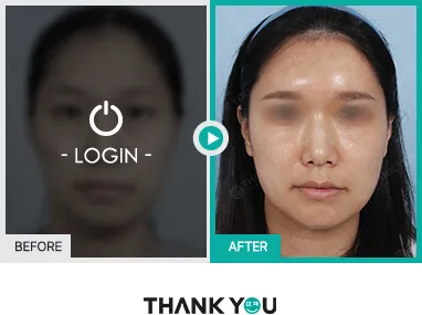 Before/After