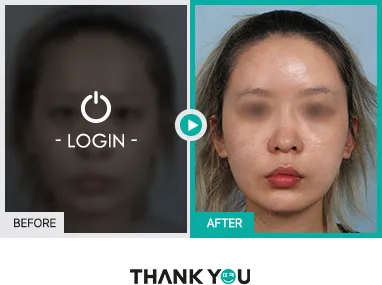 Before/After