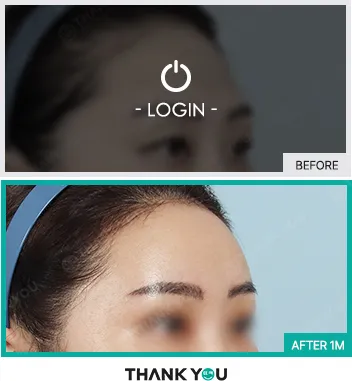 Before & After