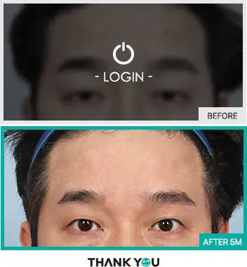 Before/After
