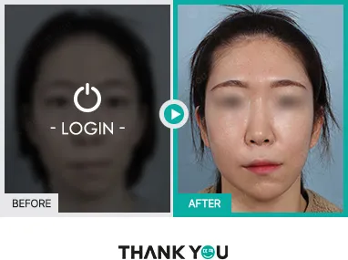 Before/After