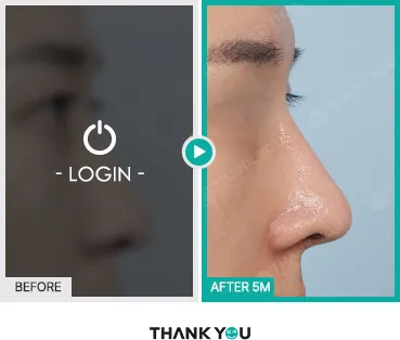 Before/After