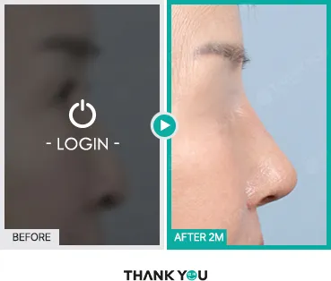Before/After