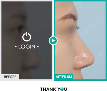 Before/After