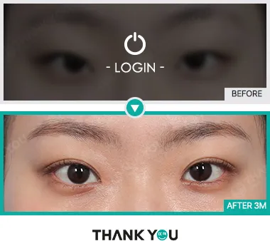 Before/After