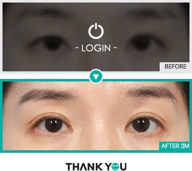 Before/After