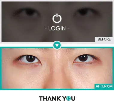 Before & After