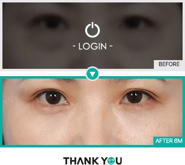 Before/After