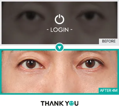 Before & After