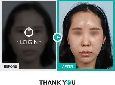 Before/After