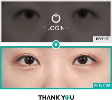 Before/After