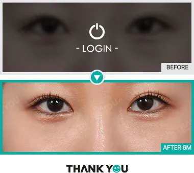 Before/After