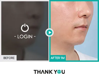 Before/After