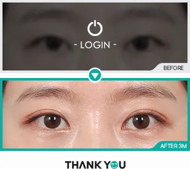 Before/After