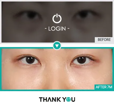Before/After