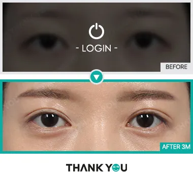 Before/After