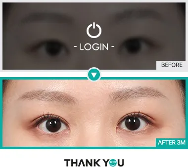 Before/After