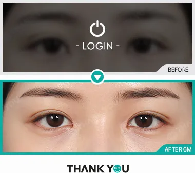 Before/After